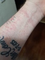 Left wrist.jpg