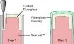 CappingStep1_2.jpg